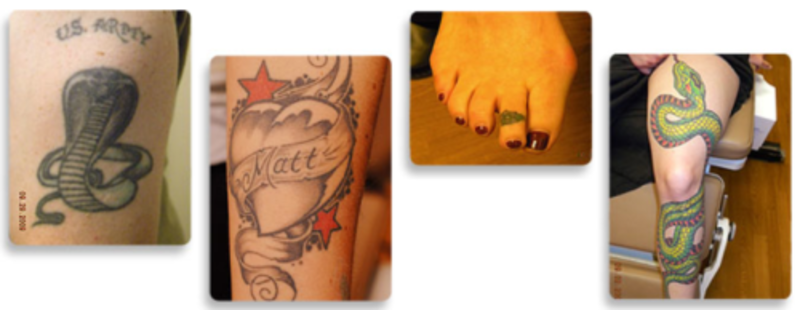 File:blinktats.png